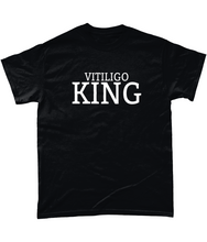 Load image into Gallery viewer, Vitiligo King Adult Tee