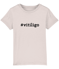 Load image into Gallery viewer, #vitiligo Kids Tee