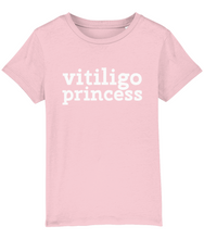 Load image into Gallery viewer, vitiligo princess  Kids Tee